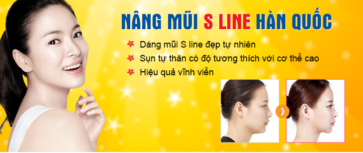 Nâng mũi S line tạo hình 3D tại Hà Thanh Nâng mũi S line tạo hình 3D tại Hà Thanh