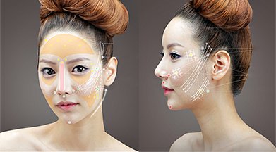 Căng da mặt bằng chỉ vàng 24K
