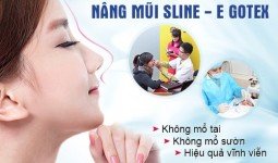 Nâng mũi an toàn uy tín tại Hà Nội