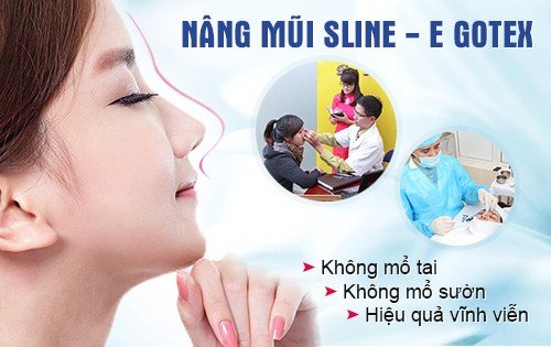 Nâng mũi an toàn uy tín tại Hà Nội