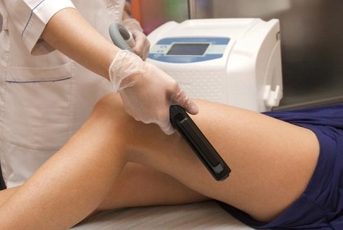 Điều trị sẹo thâm ở chân bằng Q Laser