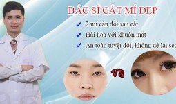 Bác sĩ nào cắt mí mắt đẹp tại Hà Nội