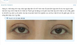 Hình ảnh thực tế của 1 chị em cắt mí mắt tại hà Thanh chia sẻ trên webtretho