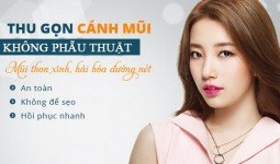 Ưu điểm của thu nhỏ cánh mũi không cần phẫu thuật