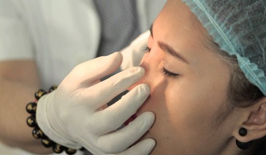 Tiêm filler nâng mũi có hại không phụ thuộc vào tay nghề bác sĩ