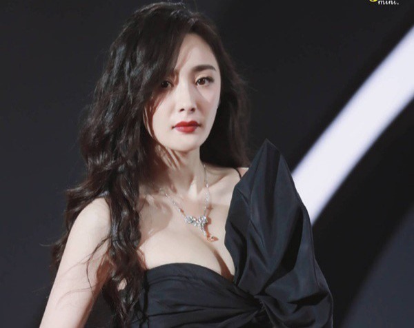 Ưu điểm phẫu thuật cười hở lợi