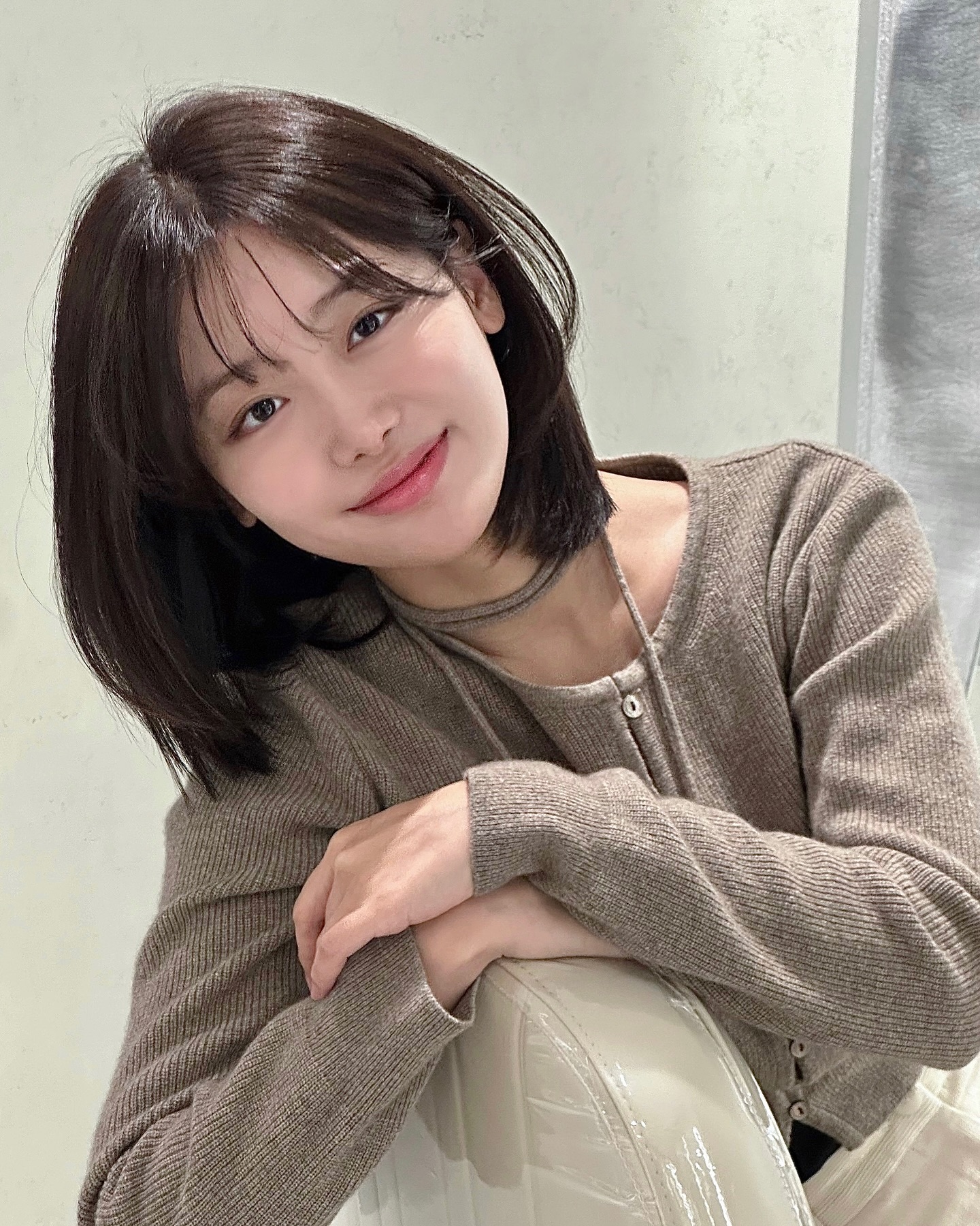 Hình ảnh thực tế trước – sau cắt mí của khách hàng